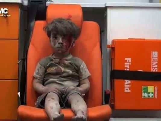 ‘Aleppo Child Survivor Image Will be Used as Propaganda for More War – Not Less’
